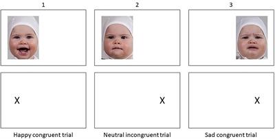 Emotional Infant Face Processing in Women With Major Depression and Expecting Parents With Depressive Symptoms